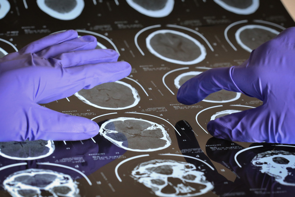 Scientists looking at medical scans