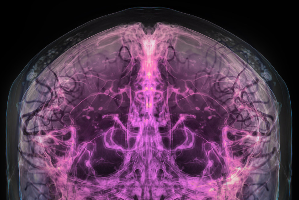 New institute envisions future where our brains last as long as our bodies